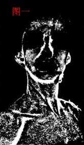 PS滤镜磨皮教程：结合色彩校正快速修饰人物照片